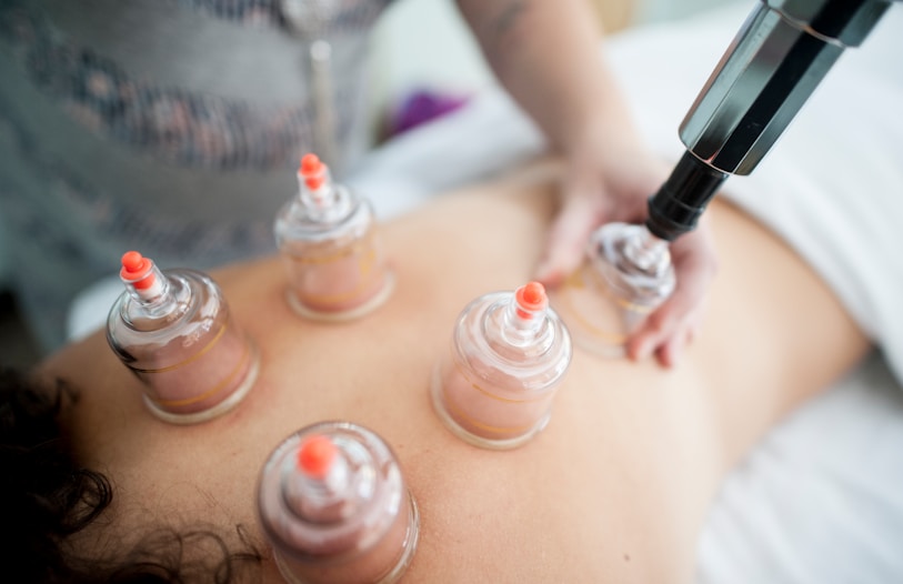 Cupping