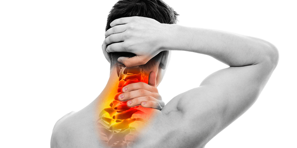 Cervicogenic Headaches