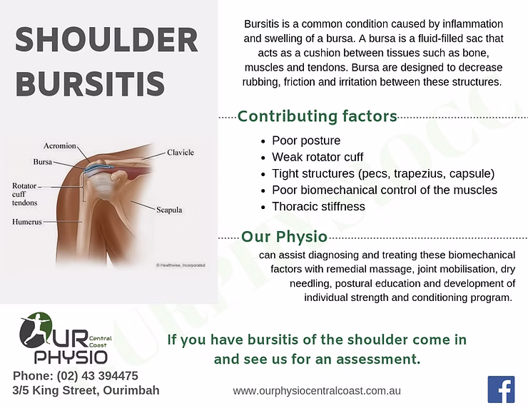 Shoulder Bursitis and how Our Physio can help your recovery